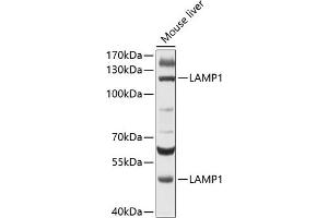 Western blot analysis of extracts of mouse liver, using L antibody (ABIN6130048, ABIN6143079, ABIN6143080 and ABIN6215226) at 1:500 dilution. (LAMP1 antibody  (AA 80-280))