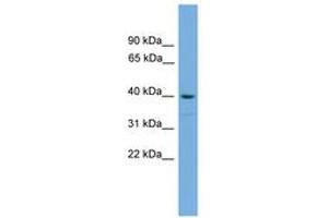 Image no. 1 for anti-SAM Domain, SH3 Domain and Nuclear Localization Signals, 1 (SAMSN1) (C-Term) antibody (ABIN6744811) (SAMSN1 antibody  (C-Term))