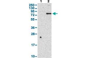 Western Blot analysis with CD248 polyclonal antibody .