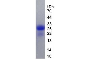 SDS-PAGE analysis of Rat Calbindin Protein. (CALB1 Protein)