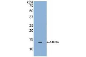 Detection of Recombinant MIF, Mouse using Polyclonal Antibody to Macrophage Migration Inhibitory Factor (MIF) (MIF antibody)