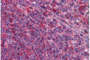 Human Spleen: Formalin-Fixed, Paraffin-Embedded (FFPE) (MIA3 antibody  (AA 1-120))