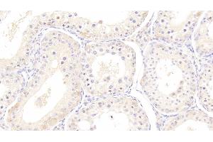 Detection of HSPA1B in Bovine Testis Tissue using Monoclonal Antibody to Heat Shock 70 kDa Protein 1B (HSPA1B) (HSPA1B antibody  (AA 1-641))