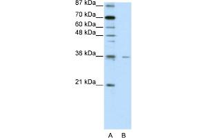 WB Suggested Anti-FOXQ1 Antibody Titration:  2. (FOXQ1 antibody  (N-Term))