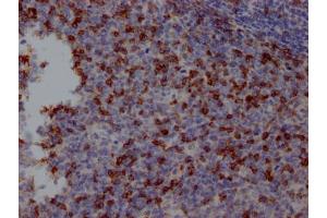 IHC image of ABIN7127671 diluted at 1:100 and staining in paraffin-embedded human tonsil tissue performed on a Leica BondTM system. (Recombinant PD-1 antibody)