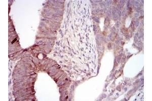 Immunohistochemistry (IHC) image for anti-Maternal Embryonic Leucine Zipper Kinase (MELK) antibody (ABIN1108210) (MELK antibody)