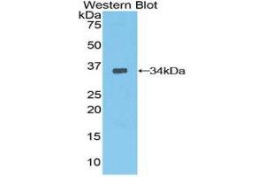 Western Blotting (WB) image for anti-3-phosphoinositide Dependent Protein Kinase-1 (PDPK1) (AA 83-338) antibody (ABIN1860177)
