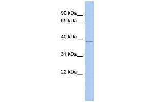 WB Suggested Anti-PNMA1 Antibody Titration:  0. (PNMA1 antibody  (Middle Region))