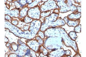 Formalin-fixed, paraffin-embedded human Placenta stained with CD71 Monoclonal Antibody (TFRC/1818).