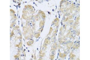 Immunohistochemistry of paraffin-embedded Human stomach using FANCA Polyclonal Antibody at dilution of 1:100 (40x lens). (FANCA antibody)