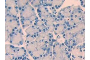 Detection of CRF in Rat Pancreas Tissue using Polyclonal Antibody to Corticotropin Releasing Factor (CRF) (CRH antibody  (AA 39-187))
