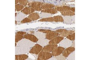 Immunohistochemical staining of human skeletal muscle with BCHE polyclonal antibody  shows moderate cytoplasmic positivity in myocytes at 1:50-1:200 dilution. (Butyrylcholinesterase antibody)