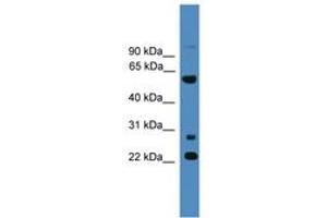 Image no. 1 for anti-Meiosis-Specific Nuclear Structural 1 (MNS1) (AA 91-140) antibody (ABIN6746497) (MNS1 antibody  (AA 91-140))