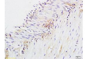 Formalin-fixed and paraffin embedded rat colitis labeled with Anti-CD28 Polyclonal Antibody, Unconjugated  at 1:200 followed by conjugation to the secondary antibody and DAB staining. (CD28 antibody  (AA 1-120))