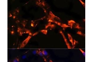 Immunofluorescence analysis of NIH/3T3 cells using DPP4 Polyclonal Antibody at dilution of 1:100. (DPP4 antibody)
