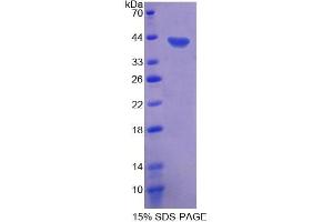 SDS-PAGE (SDS) image for CD9 (CD9) (AA 112-195) protein (His tag,GST tag) (ABIN4988602)