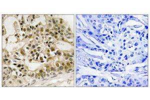 Immunohistochemistry (IHC) image for anti-V-Myb Myeloblastosis Viral Oncogene Homolog (Avian) (MYB) (pSer532) antibody (ABIN1847796) (MYB antibody  (pSer532))