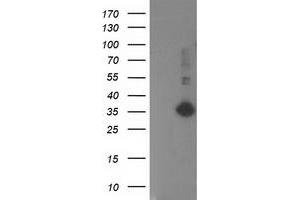 Western Blotting (WB) image for anti-Sirtuin 5 (SIRT5) antibody (ABIN1500935) (SIRT5 antibody)