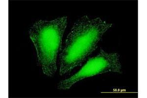 Immunofluorescence of monoclonal antibody to ATOX1 on HeLa cell. (ATOX1 antibody  (AA 1-68))