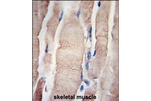 Formalin-fixed and paraffin-embedded human skeletal muscle tissue reacted with PHPT1 polyclonal antibody  , which was peroxidase-conjugated to the secondary antibody, followed by DAB staining. (PHPT1 antibody  (C-Term))