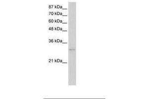 Image no. 3 for anti-Exosome Component 6 (EXOSC6) (N-Term) antibody (ABIN202141) (EXOSC6 antibody  (N-Term))