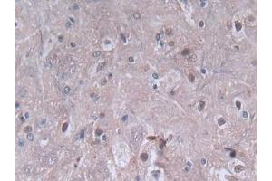 DAB staining on IHC-P; Samples: Rat Spinal cord Tissue (PF4 antibody  (AA 30-105))