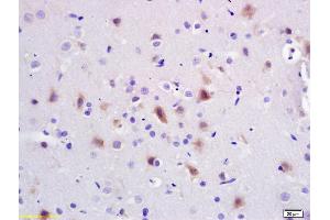 Formalin-fixed and paraffin embedded rat brain labeled with Anti-PI3K/PI3 kinase p85 alpha subunit Polyclonal Antibody, Unconjugated (ABIN725405) at 1:200 followed by conjugation to the secondary antibody and DAB staining.