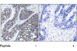 Image no. 1 for anti-PTK2B Protein tyrosine Kinase 2 beta (PTK2B) (Tyr402) antibody (ABIN197440) (PTK2B antibody  (Tyr402))