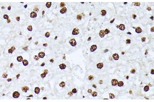 Immunohistochemistry of paraffin-embedded Mouse liver using Phospho-ATF2(T69/T71) Polyclonal Antibody at dilution of 1:100 (40x lens). (ATF2 antibody  (pThr69, pThr71))