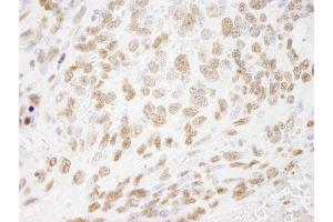 Immunohistochemistry (IHC) image for anti-Histone H3 (H3) (C-Term) antibody (ABIN7448974) (Histone 3 antibody  (C-Term))