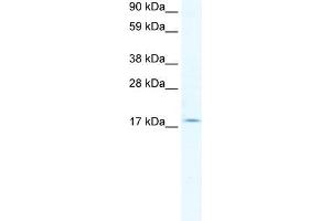 Human Lung; WB Suggested Anti-PQBP1 Antibody Titration: 2. (PQBP1 antibody  (Middle Region))