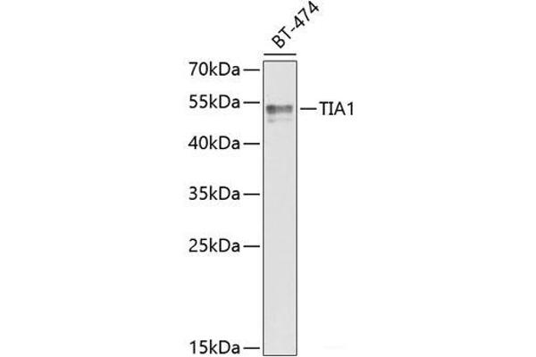 TIA1 antibody