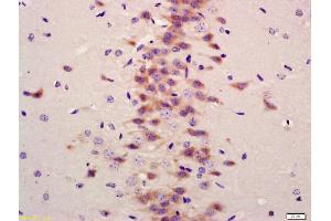 Formalin-fixed and paraffin embedded mouse brain labeled with Anti-LC3A/B Polyclonal Antibody, Unconjugated (ABIN1386290) at 1:200 followed by conjugation to the secondary antibody and DAB staining (LC3A / LC3B (AA 31-121) antibody)