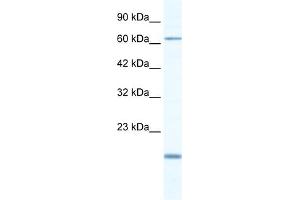WB Suggested Anti-TBX5 Antibody Titration:  0. (T-Box 5 antibody  (N-Term))