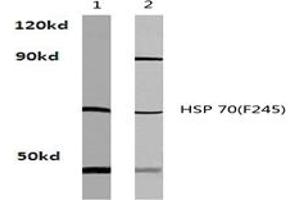 Image no. 2 for anti-Heat Shock Protein 70 (HSP70) antibody (ABIN317710) (HSP70 antibody)