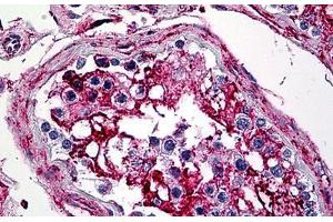 Human Testis: Formalin-Fixed, Paraffin-Embedded (FFPE) (Annexin V antibody  (AA 1-321))