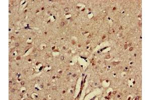 Immunohistochemistry of paraffin-embedded human brain tissue using ABIN7151843 at dilution of 1:100 (EPH Receptor A5 antibody  (AA 246-514))