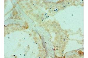 Immunohistochemistry of paraffin-embedded human testis tissue using ABIN7150791 at dilution of 1:100 (DYRK2 antibody  (AA 502-601))