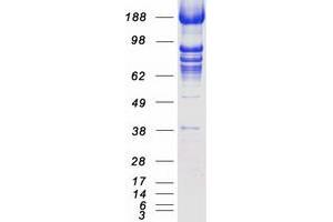 Validation with Western Blot (TACC3 Protein (Myc-DYKDDDDK Tag))