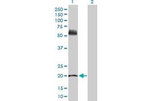 Western Blot analysis of KRT81 expression in transfected 293T cell line by KRT81 MaxPab polyclonal antibody. (KRT81 antibody  (AA 1-202))