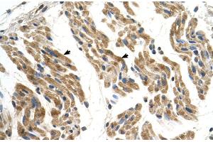 Human Muscle (SLC35F2 antibody  (N-Term))
