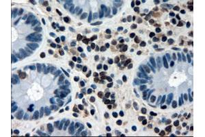 Immunohistochemical staining of paraffin-embedded colon using anti-APOM (ABIN2452530) mouse monoclonal antibody. (Apolipoprotein M antibody  (AA 23-188))