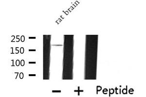 Western blot analysis of IQGAP1 expression in Rat brain lysate (IQGAP1 antibody  (N-Term))