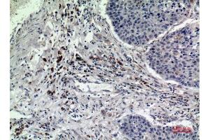 Immunohistochemistry (IHC) analysis of paraffin-embedded Human Lung, antibody was diluted at 1:100. (RAB5 antibody  (Internal Region))