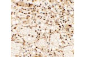 Immunohistochemistry of CLEC7A in human spleen tissue with CLEC7A antibody at 5 µg/ml. (CLEC7A antibody  (Middle Region))