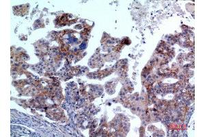 Immunohistochemistry (IHC) image for anti-Interleukin 1 Receptor, Type II (IL1R2) (Internal Region) antibody (ABIN6281356)