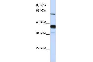 WB Suggested Anti-SMPD3 Antibody Titration:  0. (SMPD3 antibody  (Middle Region))