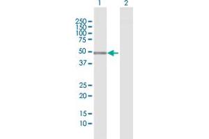 Western Blot analysis of PTPN2 expression in transfected 293T cell line by PTPN2 MaxPab polyclonal antibody. (PTPN2 antibody  (AA 1-387))