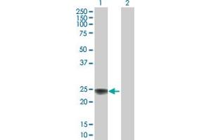 Western Blot analysis of NDUFS8 expression in transfected 293T cell line by NDUFS8 MaxPab polyclonal antibody. (NDUFS8 antibody  (AA 1-210))