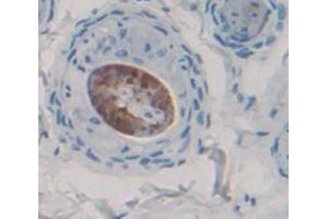 IHC-P analysis of Rat Tissue, with DAB staining. (MYD88 antibody  (AA 1-296))